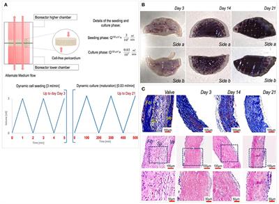 Culture Into Perfusion-Assisted Bioreactor Promotes Valve-Like Tissue Maturation of Recellularized Pericardial Membrane